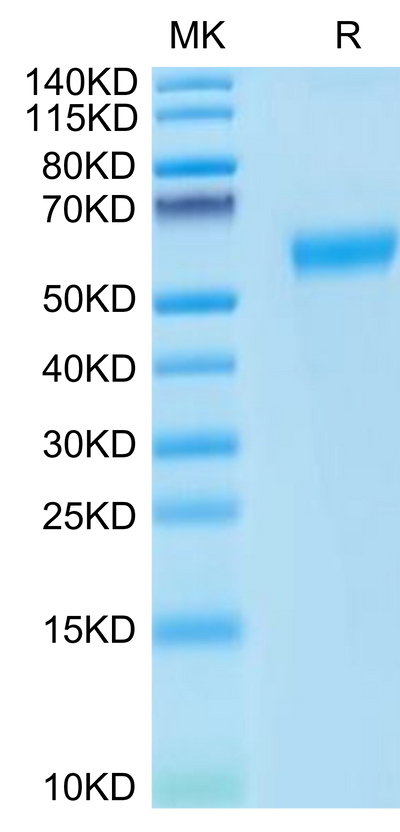 Cynomolgus PD-1 on Tris-Bis PAGE under reduced conditions. The purity is greater than 95%.Recombinant Cynomolgus PD-1/PDCD1 Protein, Active