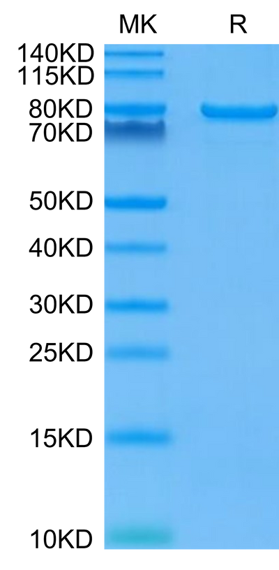 Human LAG3 on Tris-Bis PAGE under reduced condition. The purity is greater than 95%Recombinant Human LAG3/CD223 Protein, Active