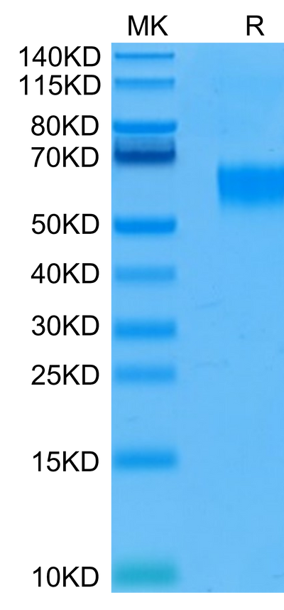 Human IL-3 R alpha on Tris-Bis PAGE under reduced condition. The purity is greater than 95%.Recombinant Human IL-3 R alpha/CD123 Protein, Active