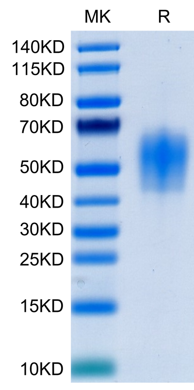 Human IL-4 R alpha on Tris-Bis PAGE under reduced condition. The purity is greater than 95%.Recombinant Human IL-4 R alpha/CD124 Protein, Active