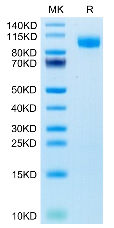 Human EGFR on Tris-Bis PAGE under reduced condition. The purity is greater than 95%.Recombinant Human EGFR/HER1 Protein, Active