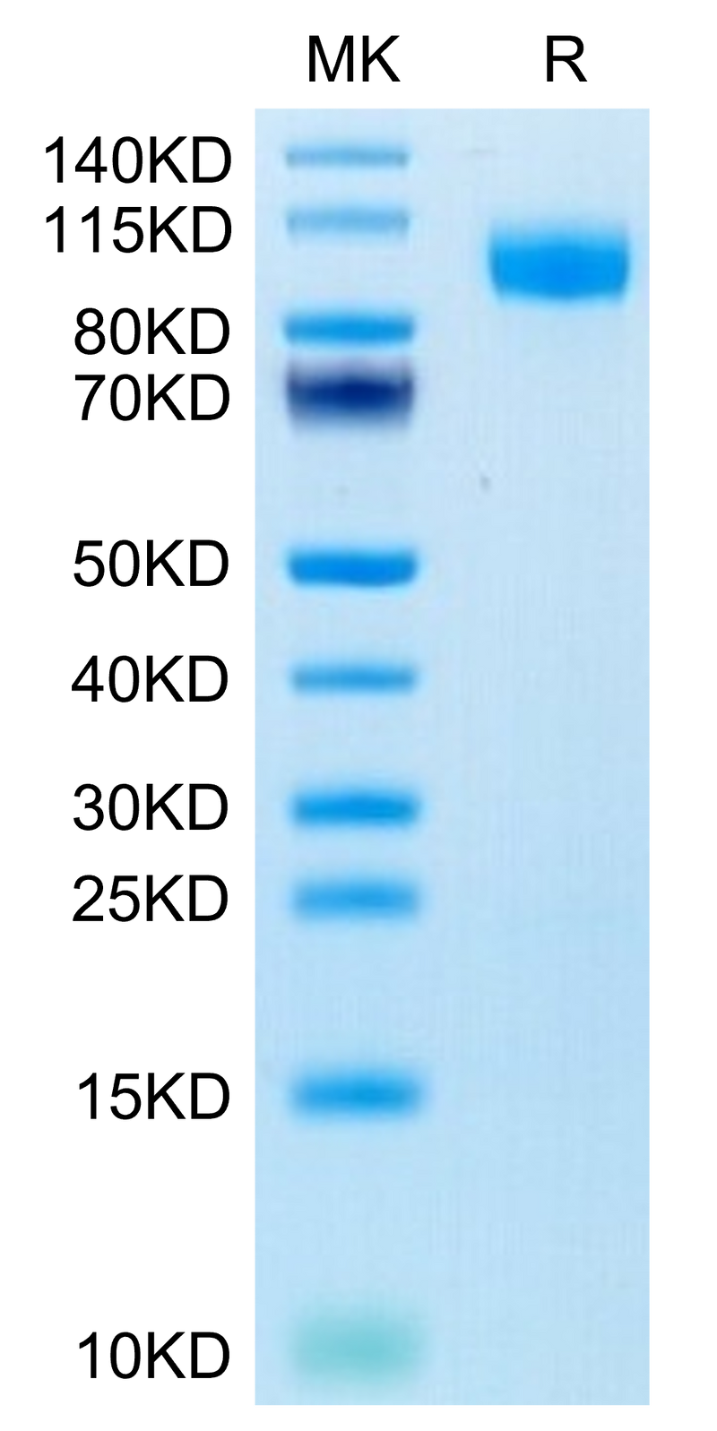 Human EGFR on Tris-Bis PAGE under reduced condition. The purity is greater than 95%.Recombinant Human EGFR/HER1 Protein, Active