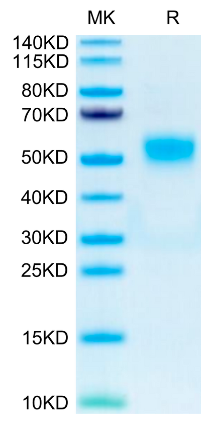 Human CD19 on Tris-Bis PAGE under reduced condition. The purity is greater than 95%.Recombinant Human CD19 Protein, Active