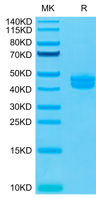 Cynomolgus CD3E&CD3G on Tris-Bis PAGE under reduced conditions. The purity is greater than 95%.Recombinant Cynomolgus CD3E&CD3G/CD3 epsilon&CD3 gamma Protein, Active