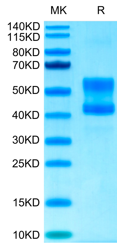 Cynomolgus CD3E&CD3D on Tris-Bis PAGE under reduced conditions. The purity is greater than 95%.Recombinant Cynomolgus CD3E&CD3D/CD3 epsilon&CD3 delta Protein, Active