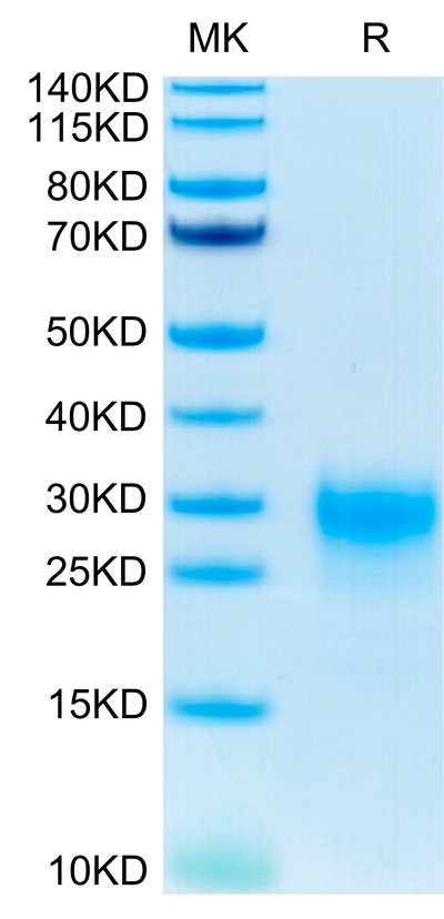 Human TSLP (R127A, R130A) on Tris-Bis PAGE under reduced condition. The purity is greater than 95%.Recombinant Human TSLP (R127A, R130A) Protein, Active