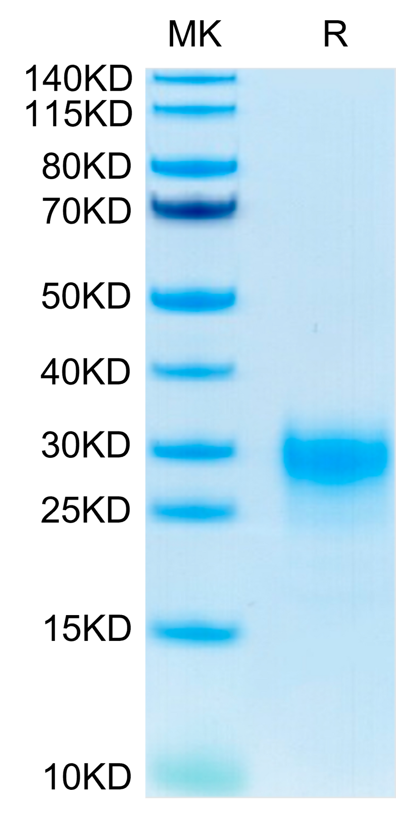 Human TSLP (R127A, R130A) on Tris-Bis PAGE under reduced condition. The purity is greater than 95%.Recombinant Human TSLP (R127A, R130A) Protein, Active