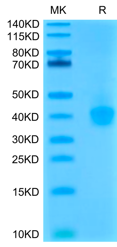 Cynomolgus/Rhesus macaque PD-L1 on Tris-Bis PAGE under reduced condition. The purity is greater than 95%.Recombinant Cynomolgus/Rhesus macaque PD-L1/B7-H1 Protein, Active
