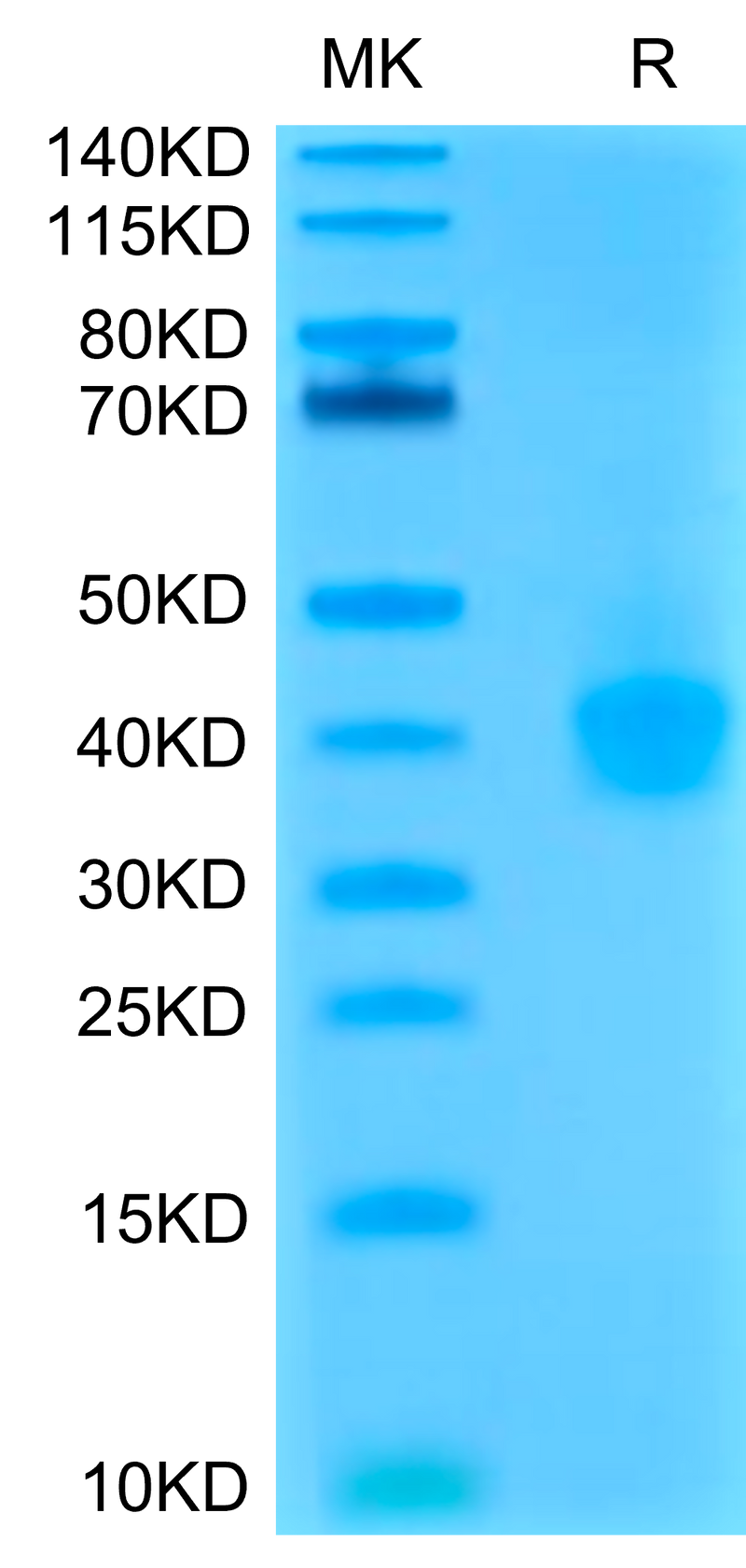 Cynomolgus/Rhesus macaque PD-L1 on Tris-Bis PAGE under reduced condition. The purity is greater than 95%.Recombinant Cynomolgus/Rhesus macaque PD-L1/B7-H1 Protein, Active