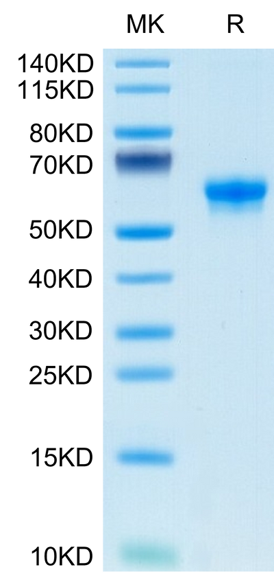 Human FLT3 Ligand on Tris-Bis PAGE under reduced condition. The purity is greater than 95%.Recombinant Human FLT3 Ligand Protein, Active