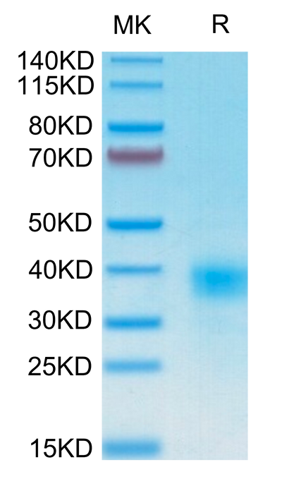 Human CD94 on Tris-Bis PAGE under reduced condition. The purity is greater than 95%.Recombinant Human CD94 Protein
