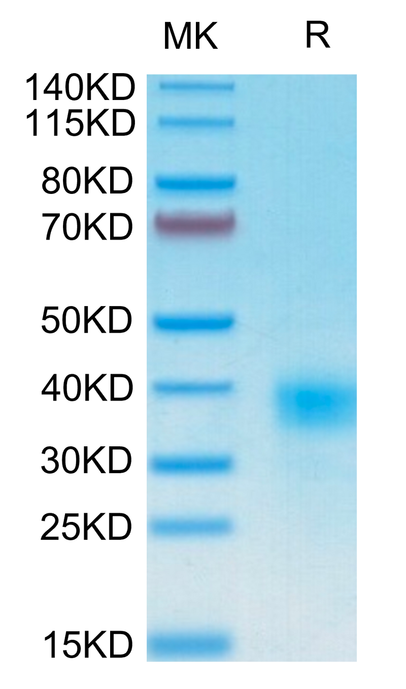 Human CD94 on Tris-Bis PAGE under reduced condition. The purity is greater than 95%.Recombinant Human CD94 Protein