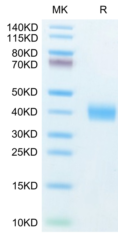 Human Galectin 3 on Tris-Bis PAGE under reduced condition. The purity is greater than 95%.Recombinant Human Galectin 3 Protein, Active