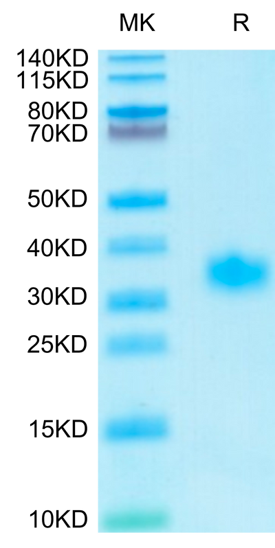 Human Adiponectin on Tris-Bis PAGE under reduced condition. The purity is greater than 95%.Recombinant Human Adiponectin/Acrp30 Protein