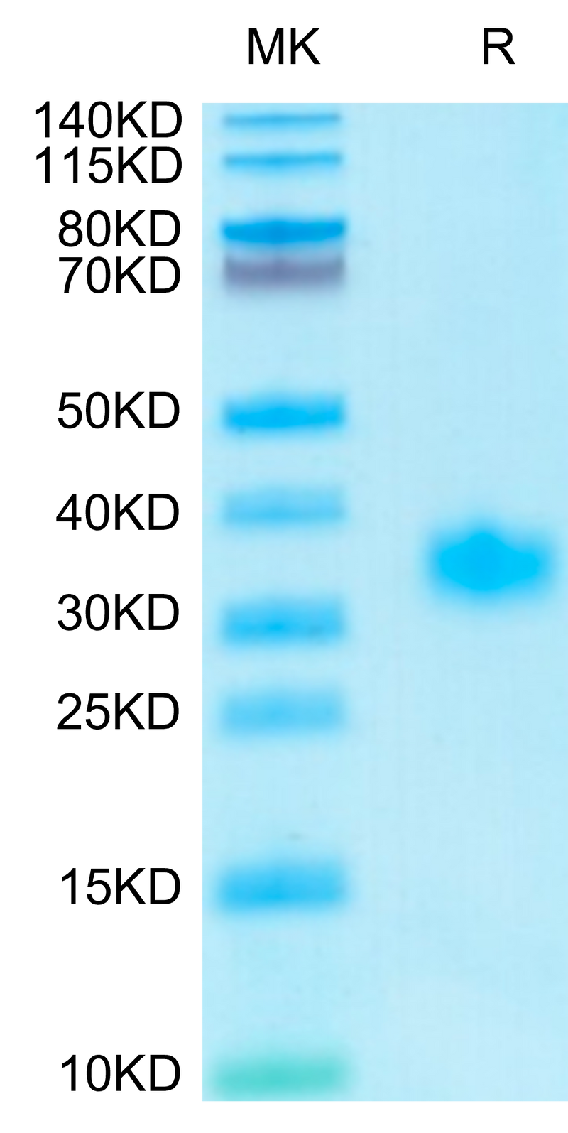 Human Adiponectin on Tris-Bis PAGE under reduced condition. The purity is greater than 95%.Recombinant Human Adiponectin/Acrp30 Protein
