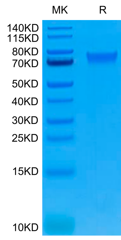 Human IL-6 R alpha on Tris-Bis PAGE under reduced conditions. The purity is greater than 95%.Recombinant Human IL-6 R alpha/CD126 Protein, Active