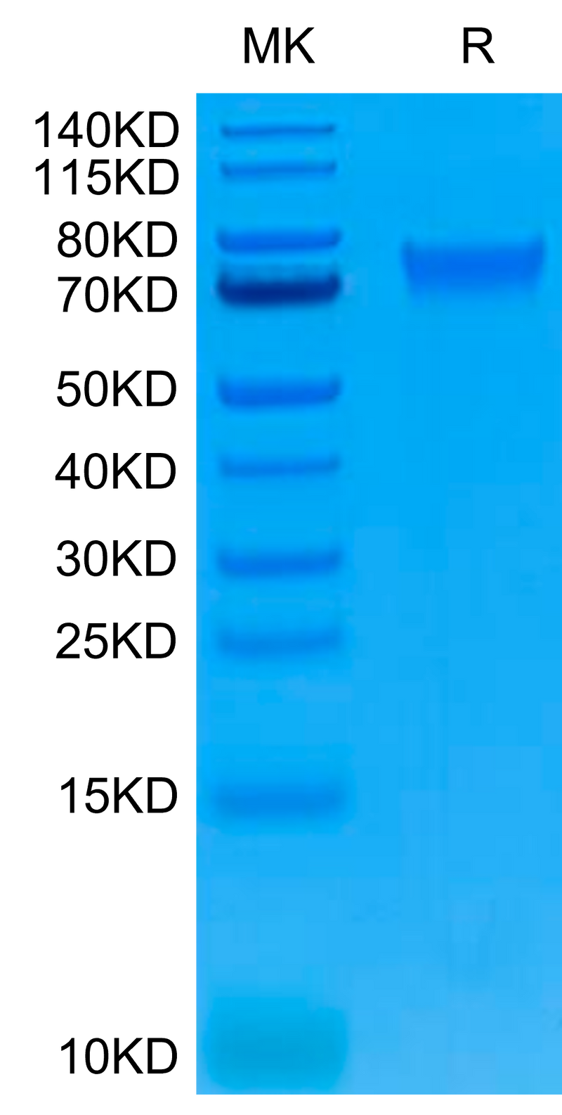 Human IL-6 R alpha on Tris-Bis PAGE under reduced conditions. The purity is greater than 95%.Recombinant Human IL-6 R alpha/CD126 Protein, Active