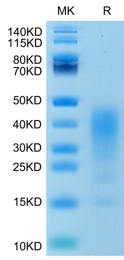 Human IL-13 on Tris-Bis PAGE under reduced condition. The purity is greater than 90%.Recombinant Human IL-13 Protein, Active