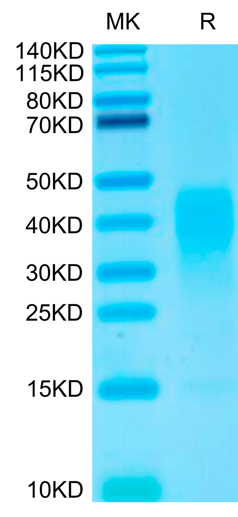 Biotinylated IL-13 on Tris-Bis PAGE under reduced conditions. The purity is greater than 90%.Biotinylated Human IL-13 Protein, Active