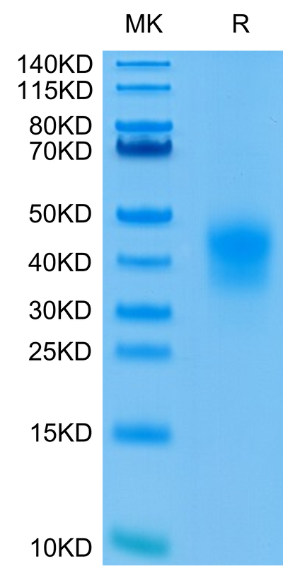 Human CD79B on Tris-Bis PAGE under reduced condition. The purity is greater than 95%.Recombinant Human CD79B Protein, Active