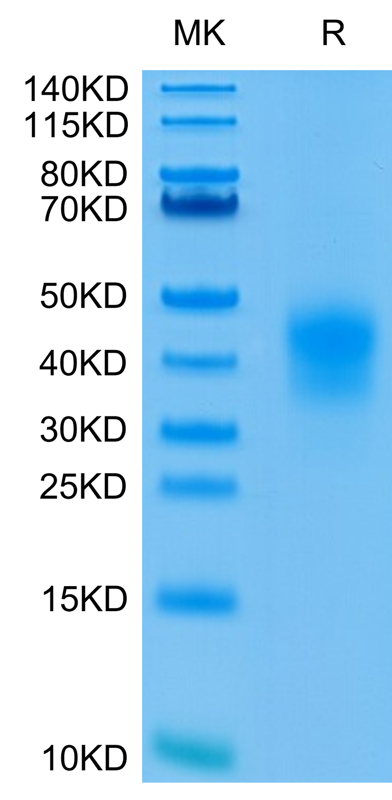 Human CD79B on Tris-Bis PAGE under reduced condition. The purity is greater than 95%.Recombinant Human CD79B Protein, Active