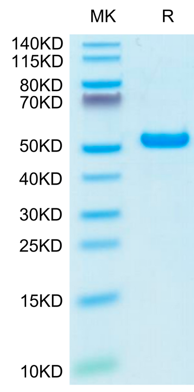 Biotinylated Human HLA-A*02:01&B2M&NY-ESO-1 (SLLMWITQV) Monomer on Tris-Bis PAGE under reduced condition. The purity is greater than 95%.Biotinylated Human HLA-A*02:01&B2M&NY-ESO-1 (SLLMWITQV) Monomer Protein, Active
