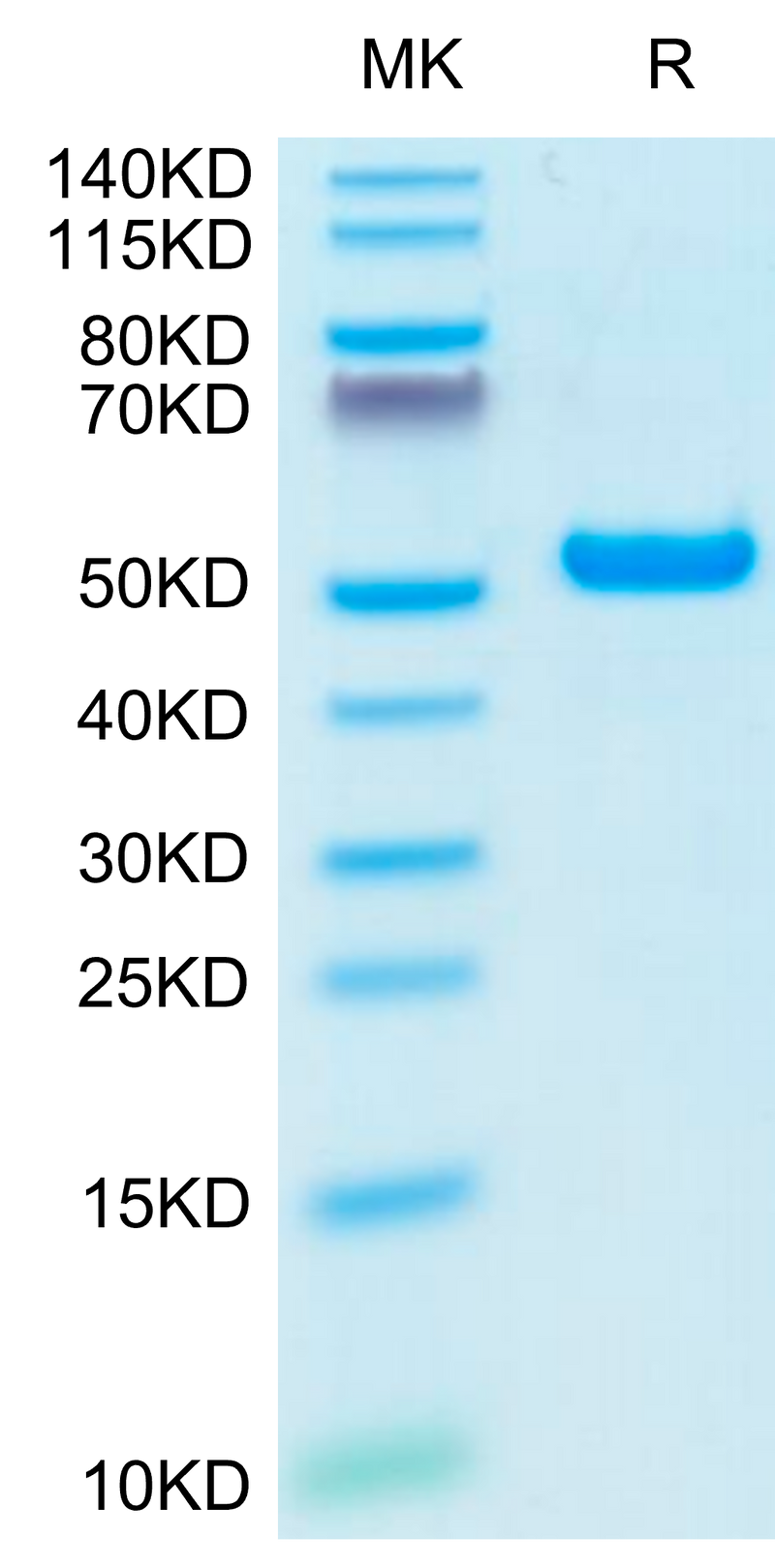 Biotinylated Human HLA-A*02:01&B2M&NY-ESO-1 (SLLMWITQV) Monomer on Tris-Bis PAGE under reduced condition. The purity is greater than 95%.