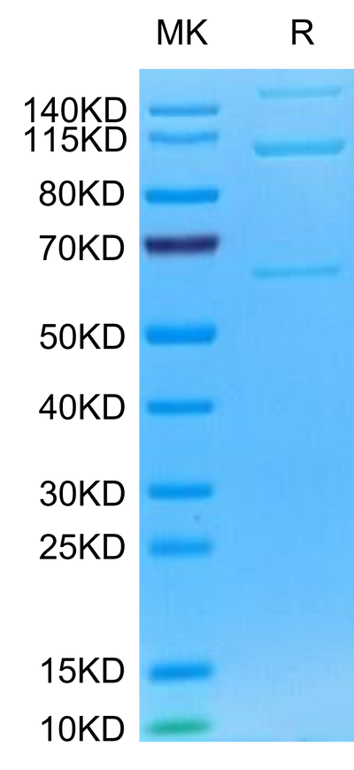Mouse Complement component 3 on Tris-Bis PAGE under reduced condition. The purity is greater than 95%.Recombinant Mouse Complement component 3 Protein
