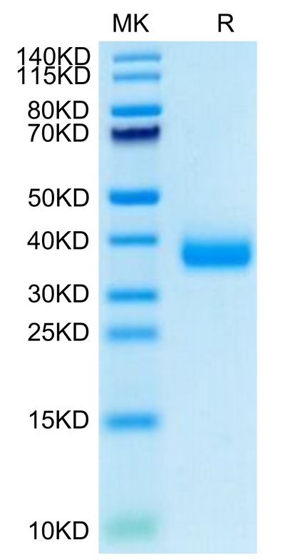 SARS-COV-2 Spike RBD (Omicron B.1.1.529) on Tris-Bis PAGE under reduced condition. The purity is greater than 95%.Recombinant SARS-COV-2 Spike RBD (Omicron B.1.1.529) Protein, Active