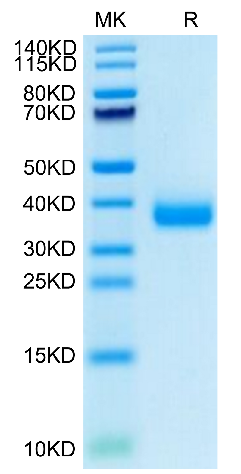 SARS-COV-2 Spike RBD (Omicron B.1.1.529) on Tris-Bis PAGE under reduced condition. The purity is greater than 95%.Recombinant SARS-COV-2 Spike RBD (Omicron B.1.1.529) Protein, Active