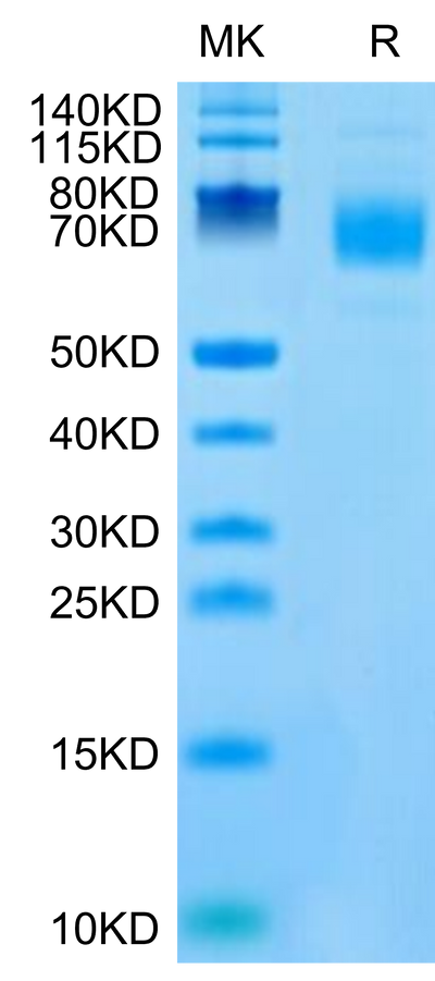 Mouse CSPG5 on Tris-Bis PAGE under reduced condition. The purity is greater than 95%.Recombinant Mouse CSPG5 Protein
