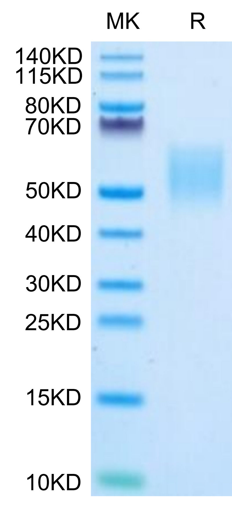 Biotinylated Human B7-H6 on Tris-Bis PAGE under reduced condition. The purity is greater than 95%.Biotinylated Human B7-H6 Protein, Active