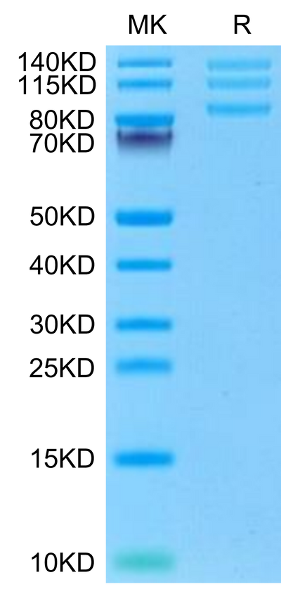 Rhesus macaque ITGAV&ITGB8 on Tris-Bis PAGE under reduced condition. The purity is greater than 95%.Recombinant Rhesus macaque Integrin alpha V beta 8 (ITGAV&ITGB8) Heterodimer Protein, Active