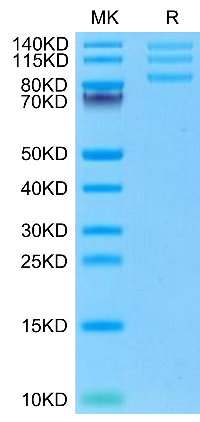 Rhesus macaque ITGAV&ITGB8 on Tris-Bis PAGE under reduced condition. The purity is greater than 95%.Recombinant Rhesus macaque Integrin alpha V beta 8 (ITGAV&ITGB8) Heterodimer Protein, Active