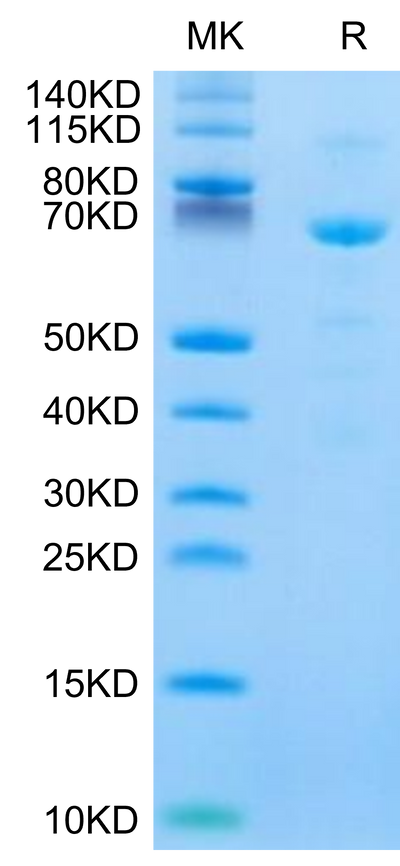 Human CDH11 on Tris-Bis PAGE under reduced condition. The purity is greater than 90%.Recombinant Human CDH11/Cadherin 11 Protein
