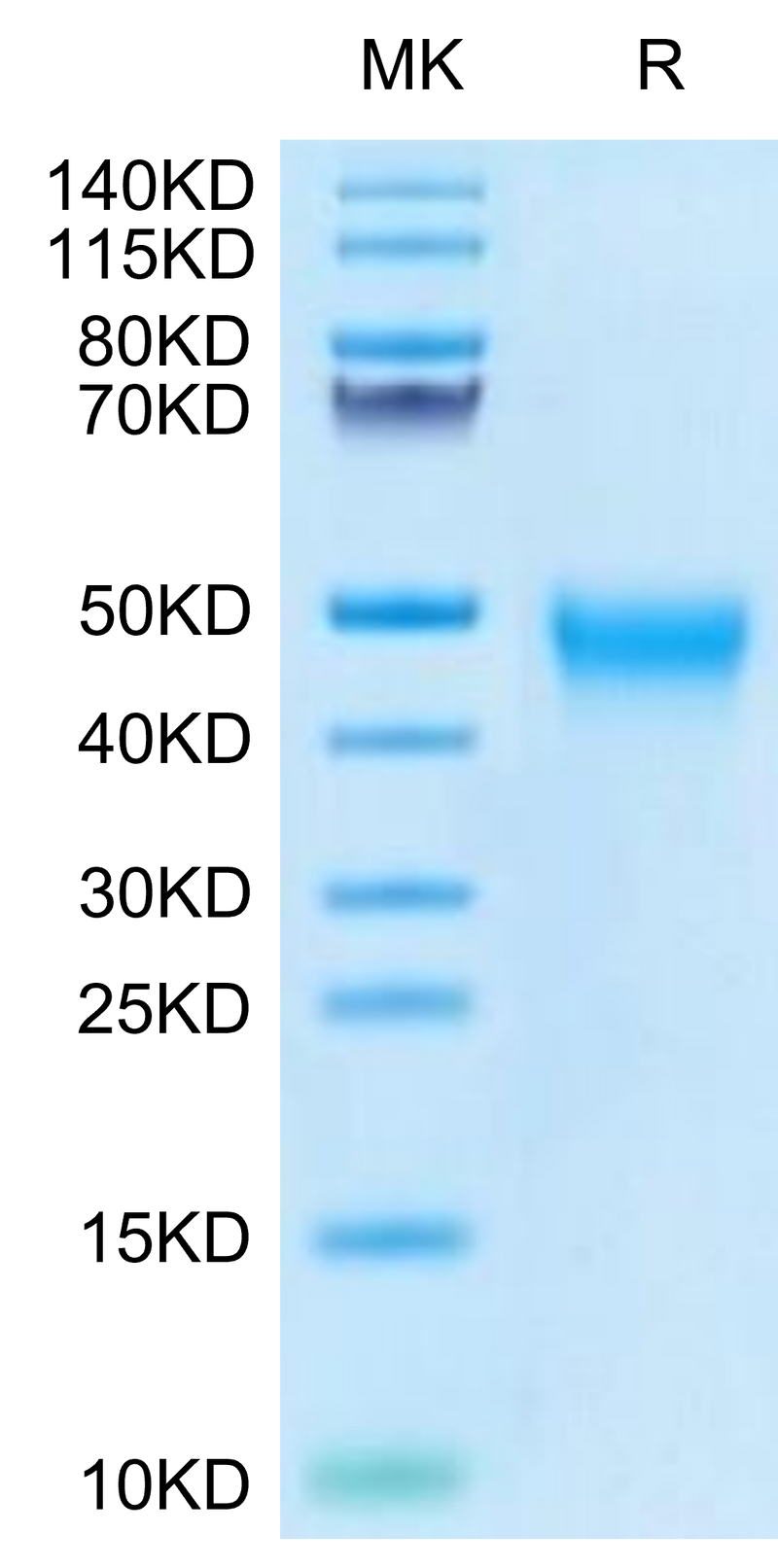 Biotinylated Human Tim-3 on Tris-Bis PAGE under reduced condition. The purity is greater than 95%.Biotinylated Human Tim-3/HAVCR2 Protein, Active