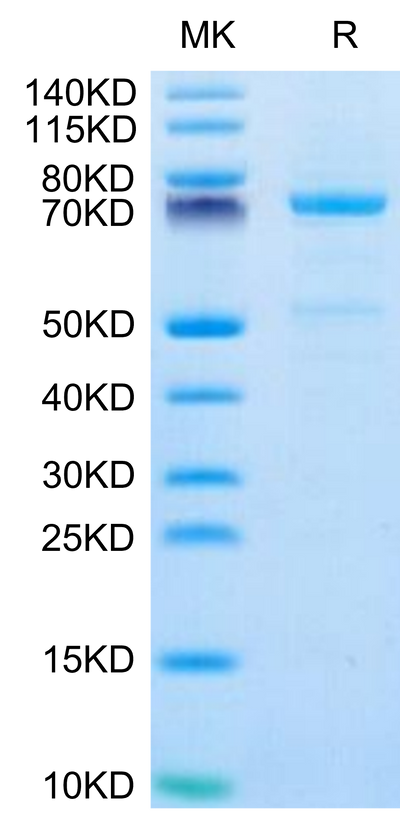 Human CDH3 on Tris-Bis PAGE under reduced condition. The purity is greater than 95%.Recombinant Human CDH3/Cadherin 3 Protein, Active