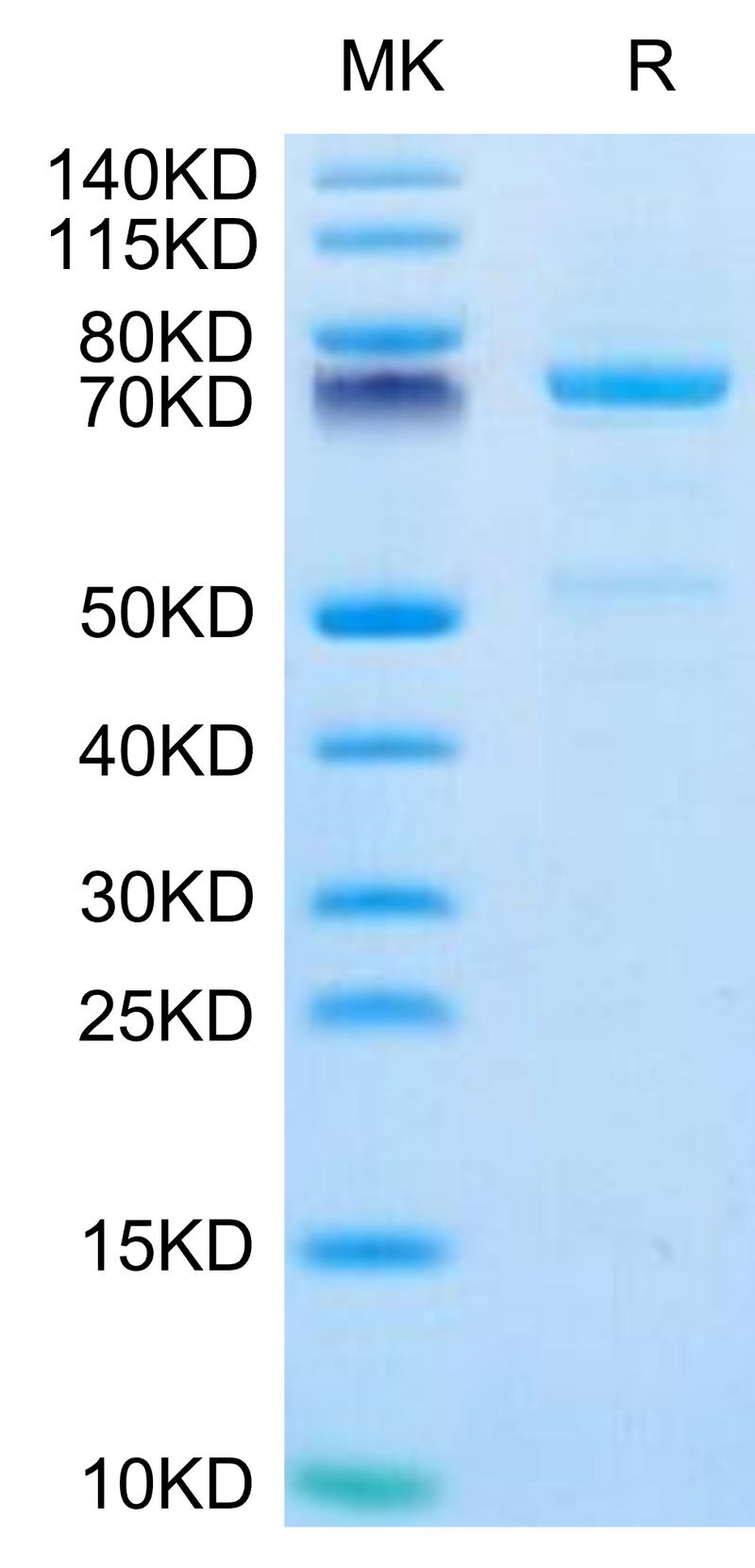 Human CDH3 on Tris-Bis PAGE under reduced condition. The purity is greater than 95%.Recombinant Human CDH3/Cadherin 3 Protein, Active