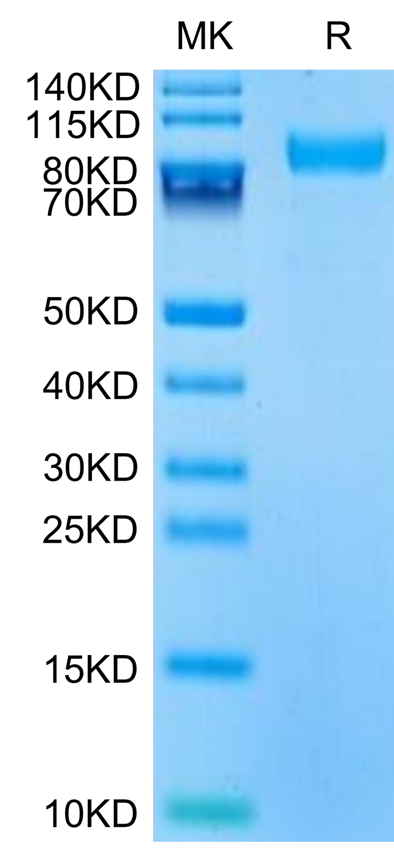 Mouse CD180 on Tris-Bis PAGE under reduced condition. The purity is greater than 95%.Recombinant Mouse CD180 Protein