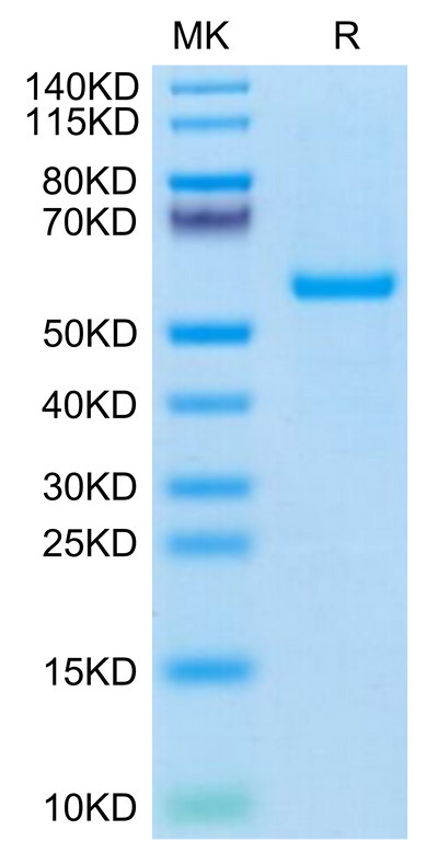 Human HLA-A*03:01&B2M&KRAS WT (VVVGAGGVGK) Monomer on Tris-Bis PAGE under reduced condition. The purity is greater than 95%.Recombinant Human HLA-A*03:01&B2M&KRAS WT (VVVGAGGVGK) Monomer Protein