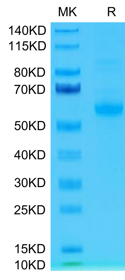 Human Siglec-15 on Tris-Bis PAGE under reduced condition. The purity is greater than 95%.Recombinant Human Siglec-15/CD33L3 Protein, Active