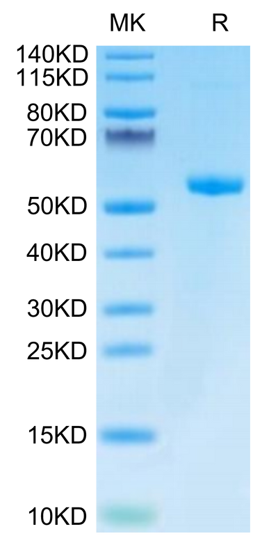 Biotinylated Human HLA-A*03:01&B2M&KRAS WT (VVVGAGGVGK) Monomer on Tris-Bis PAGE under reduced condition. The purity is greater than 95%.Biotinylated Human HLA-A*03:01&B2M&KRAS WT (VVVGAGGVGK) Monomer Protein