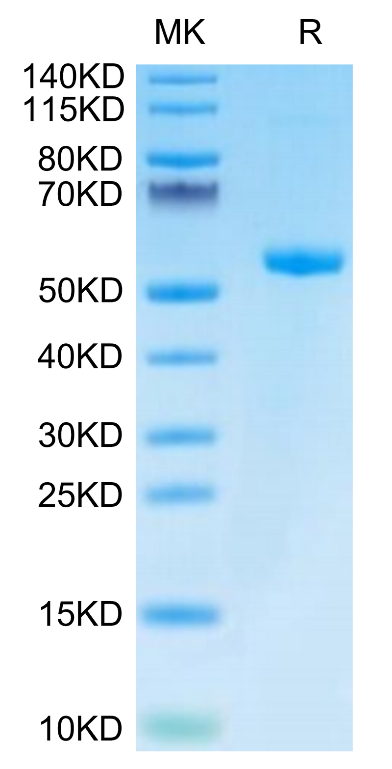 Biotinylated Human HLA-A*03:01&B2M&KRAS WT (VVVGAGGVGK) Monomer on Tris-Bis PAGE under reduced condition. The purity is greater than 95%.Biotinylated Human HLA-A*03:01&B2M&KRAS WT (VVVGAGGVGK) Monomer Protein