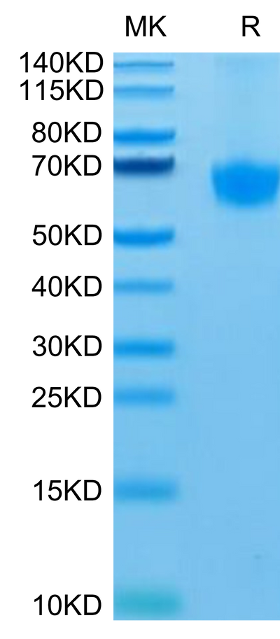 Human PD-1 on Tris-Bis PAGE under reduced condition.The purity is greater than 95%.Recombinant Human PD-1/PDCD1 Protein, Active