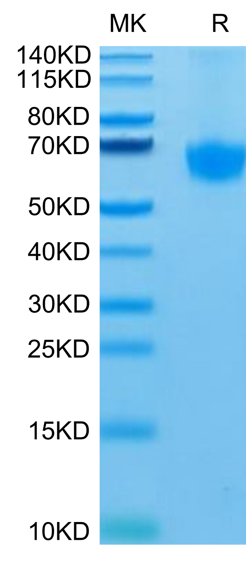 Human PD-1 on Tris-Bis PAGE under reduced condition.The purity is greater than 95%.Recombinant Human PD-1/PDCD1 Protein, Active