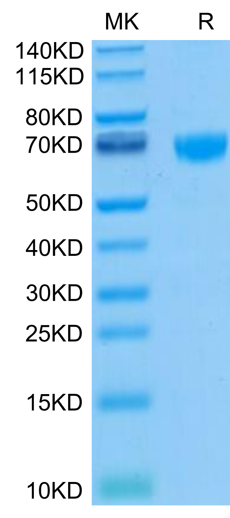 Biotinylated Human PD-1 on Tris-Bis PAGE under reduced. The purity is greater than 95%.Biotinylated Human PD-1/PDCD1 Protein, Active