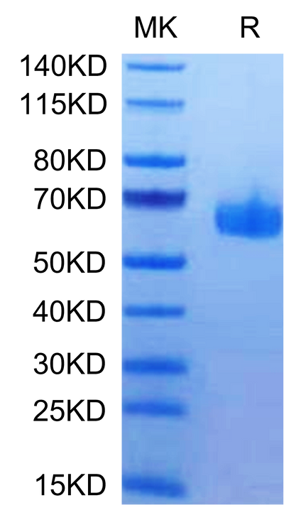 Human HVEM on Tris-Bis PAGE under reduced condition. The purity is greater than 95%.Recombinant Human HVEM/TNFRSF14 Protein, Active