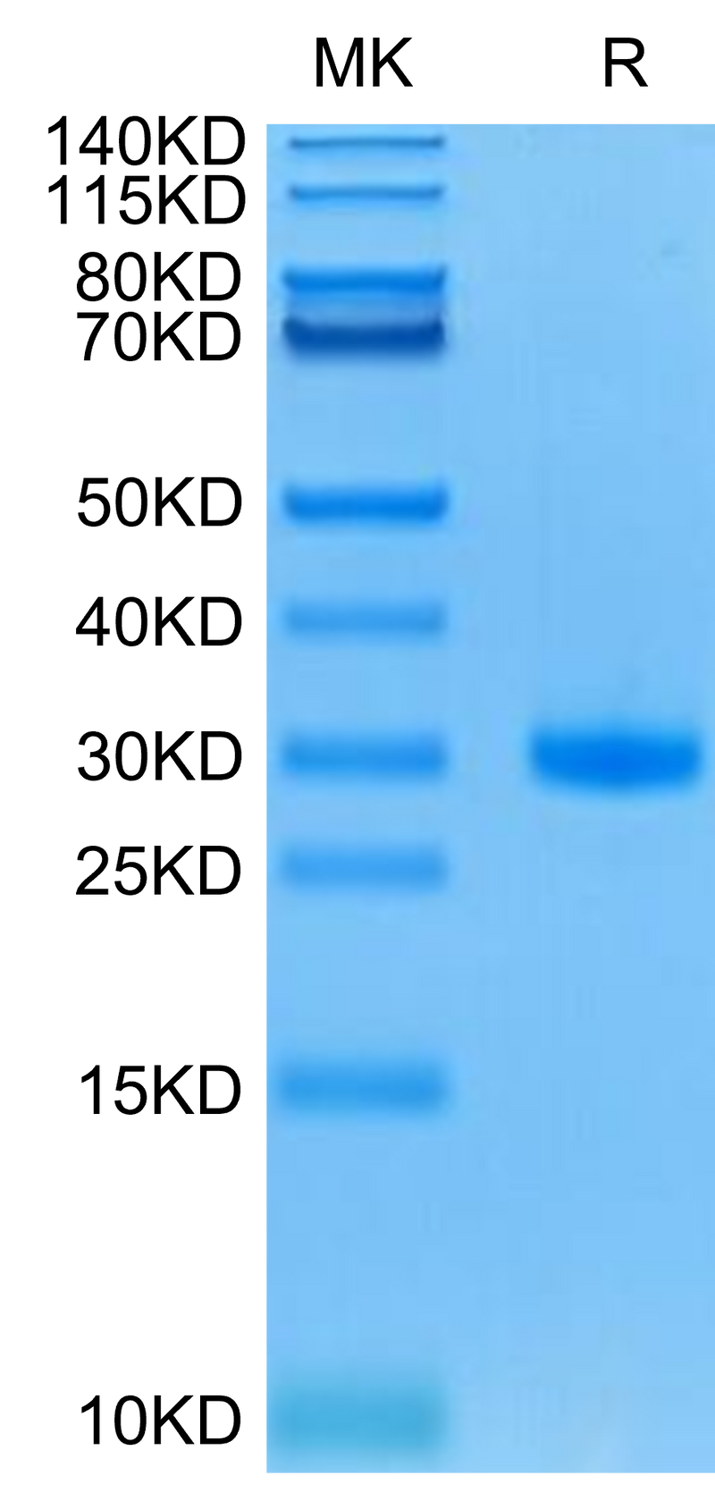 Mouse CD40 on Tris-Bis PAGE under reduced condition. The purity is greater than 95%.Recombinant Mouse CD40/TNFRSF5 Protein, Active