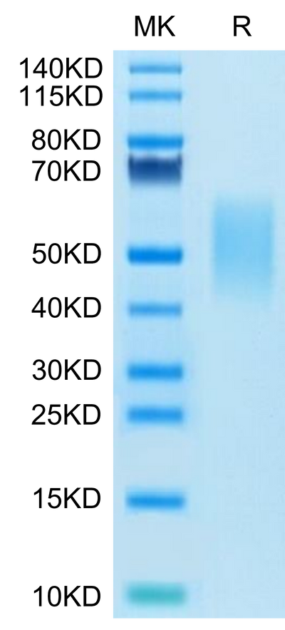 Mouse TIM-3 on Tris-Bis PAGE under reduced condition. The purity is greater than 95%.Recombinant Mouse Tim-3/HAVCR2 Protein