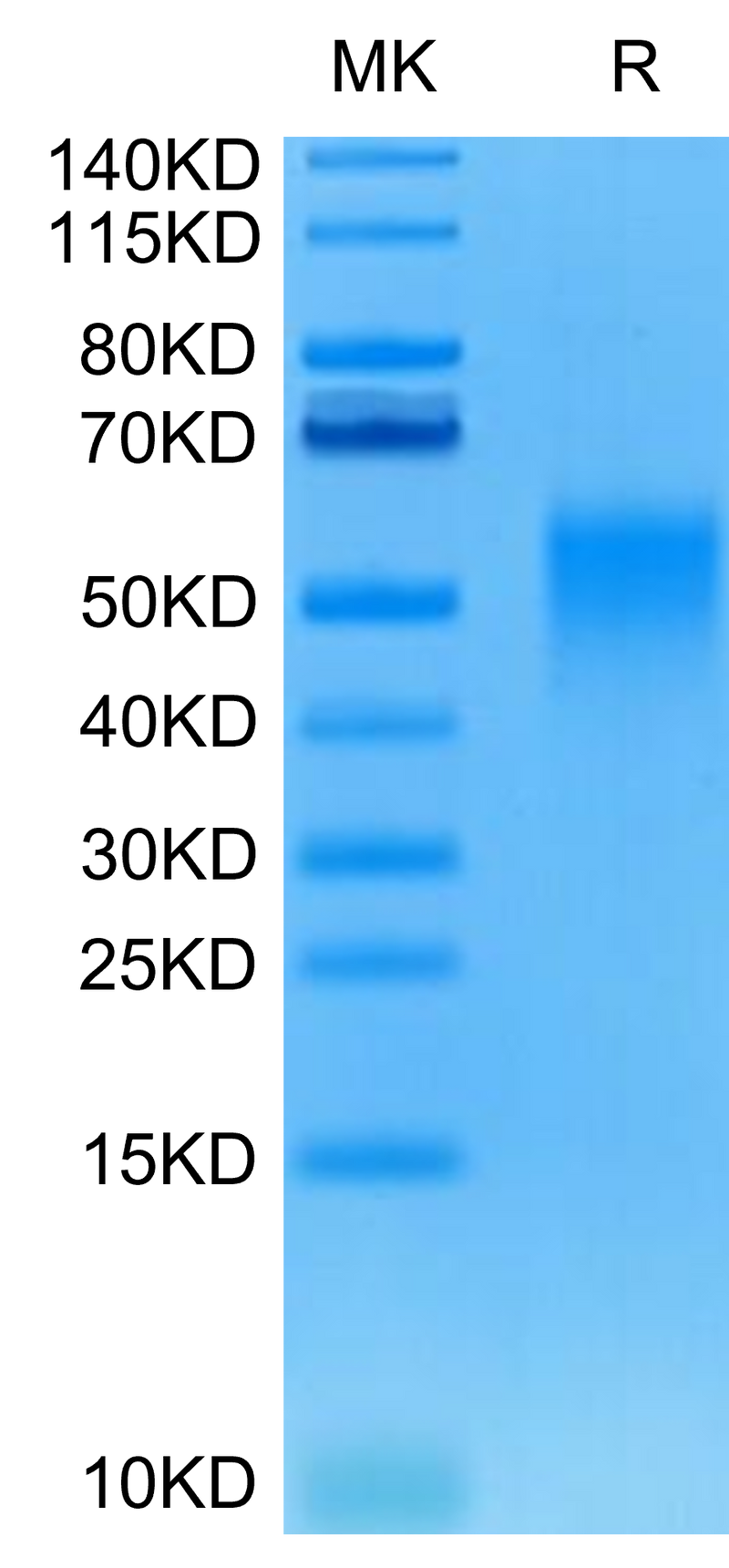 Human/Cynomolgus/Rhesus macaque CD28 on Tris-Bis PAGE under reduced condition. The purity is greater than 95%.Recombinant Human/Cynomolgus/Rhesus macaque CD28 Protein, Active
